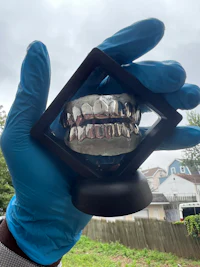 a person is holding a pair of silver teeth in a box