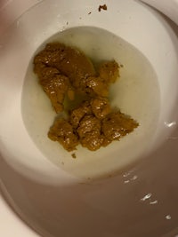 a toilet bowl with a brown substance in it