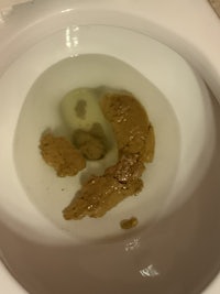 a toilet bowl with a brown substance in it