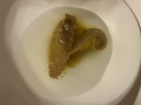 a toilet bowl with a snake in it