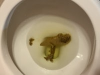 a toilet bowl with a poop in it