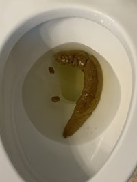 a toilet bowl with a brown substance in it