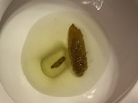 a worm in a toilet bowl