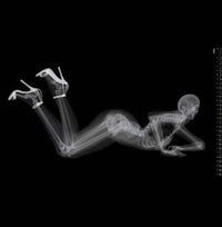 an x - ray image of a woman laying on her back