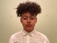a young boy with blood on his face
