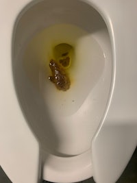 a toilet with a yellow liquid in it