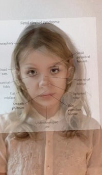 an image of a girl's face with different parts labeled