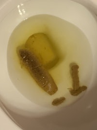a toilet with worms in it