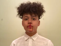 a young man with blood on his face