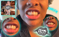 a picture of a woman's teeth with different piercings