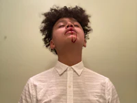 a young man with blood on his face