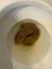 a toilet bowl with a brown substance in it