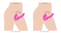 a diagram of a woman's pelvic organs and a diagram of a woman's pelvic organs