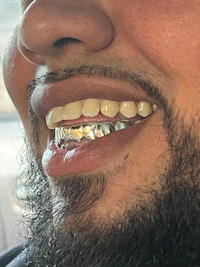 a man with a beard and silver teeth