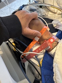 a person in a hospital bed with a bandage on their leg