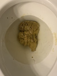 a toilet bowl with a brown substance in it