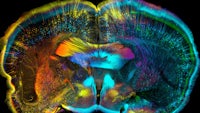 an mri image of a human brain