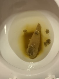 a toilet bowl with a brown substance in it