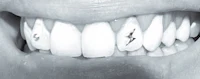 a close up of a person's teeth