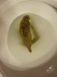 a toilet bowl with a worm in it